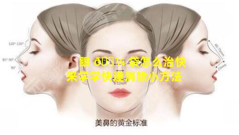 眼 🌼 袋怎么治快来学学快速消除小方法